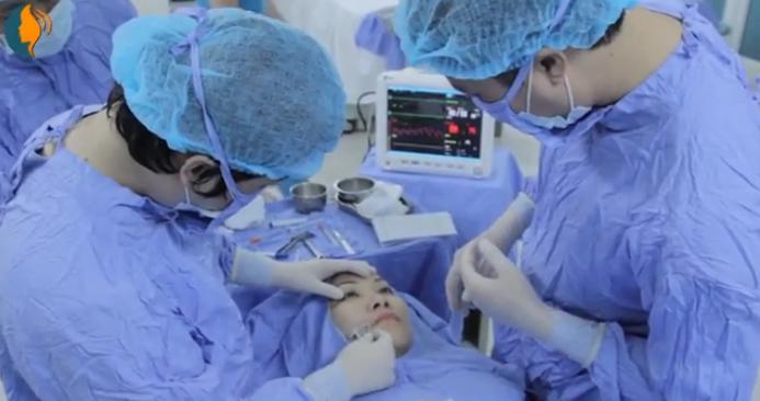 Tạo má lúm đồng tiền877