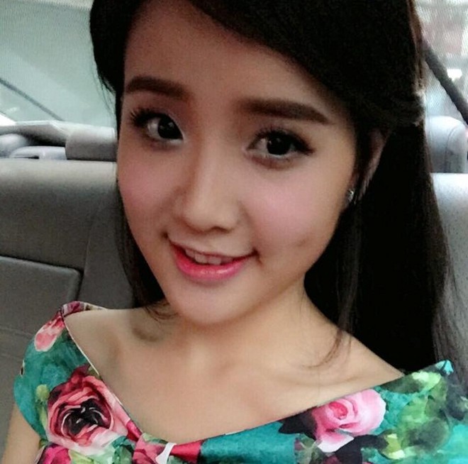 người có má lúm đồng tiền 1 bên