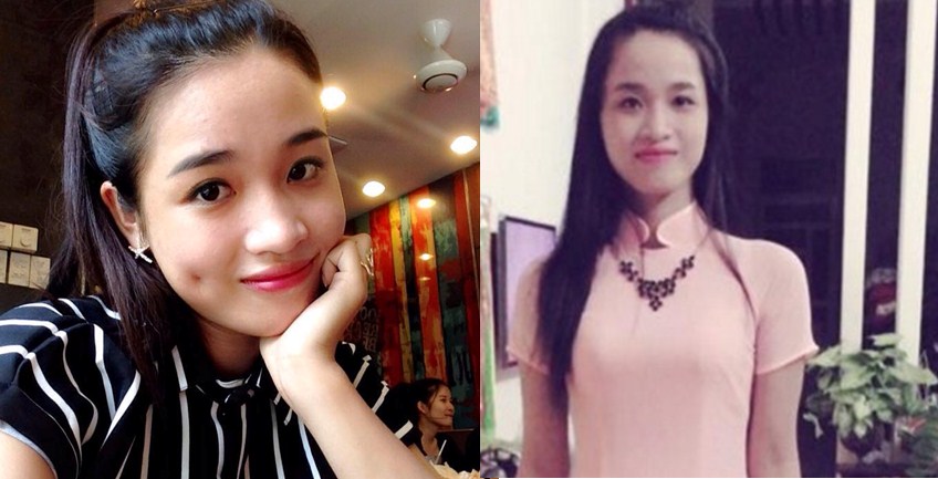Tạo má lúm đồng tiền có ảnh hưởng tới cơ miệng? 3