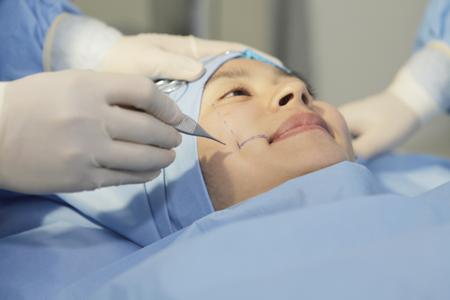 Làm má lúm đồng tiền bao lâu thì lành 