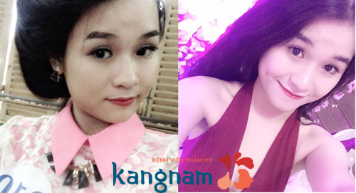 tai-sao-ma-lum-dong-tien-lai-mat-di-khi-lon-len-4