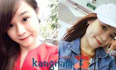 má lúm đồng tiền và răng khểnh 9