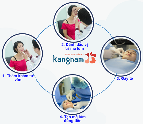 Phẫu thuật má lúm hỏng 2
