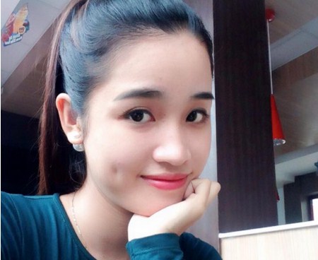 Tạo má lúm đồng tiền – “Hô biến” nụ cười xấu