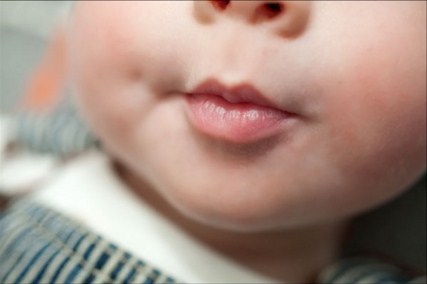 Bé có má lúm đồng tiền: Xinh ngay từ lúc lọt lòng