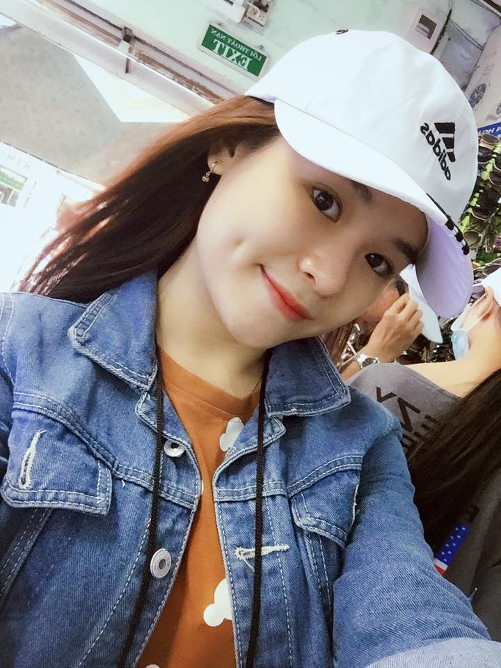 Bật mí tạo má lúm đồng tiền có vĩnh viễn không?