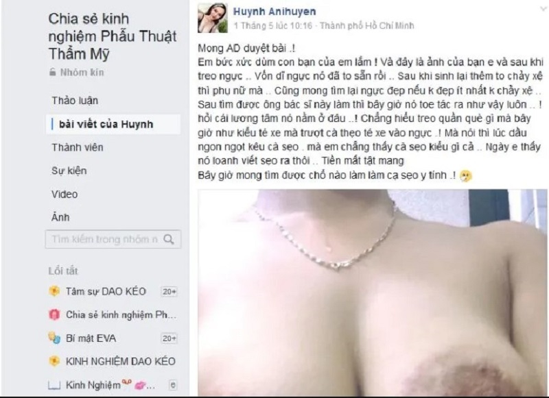 Khách hàng cho rằng “Bệnh viện thẩm mỹ kangnam lừa đảo” được chia sẻ trên nhóm phẫu thuật